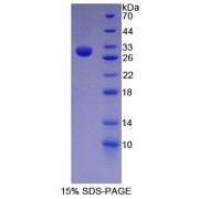 SDS-PAGE analysis of recombinant Human Nestin Protein.