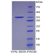 SDS-PAGE analysis of recombinant Human NCAM Protein.