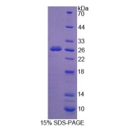 SDS-PAGE analysis of Human Sialidase-1 Protein.