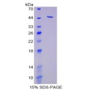 SDS-PAGE analysis of Human Neuraminidase Protein.