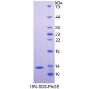 SDS-PAGE analysis of recombinant Mouse NEFL Protein.
