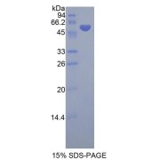 SDS-PAGE analysis of Human SMPD2 Protein.