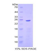 SDS-PAGE analysis of Human NGAL Protein.