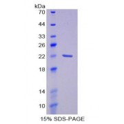 SDS-PAGE analysis of Mouse NGAL Protein.