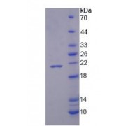 SDS-PAGE analysis of recombinant Human NOX4 Protein.
