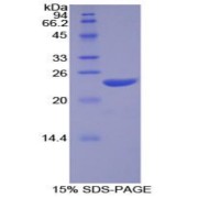 SDS-PAGE analysis of Human NOS1 Protein.