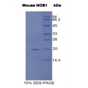 SDS-PAGE analysis of Mouse NOS1 Protein.