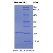 SDS-PAGE analysis of Rat NOS1 Protein.