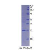 SDS-PAGE analysis of Rat NOS1 Protein.