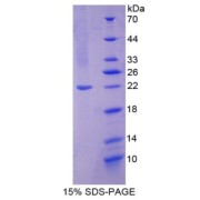 SDS-PAGE analysis of Human NOS2 Protein.