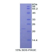 SDS-PAGE analysis of Rat NOS2 Protein.