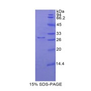 SDS-PAGE analysis of Pig NOS3 Protein.