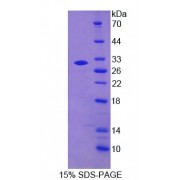 SDS-PAGE analysis of recombinant Human N-Methylpurine DNA Glycosylase (MPG) Protein.