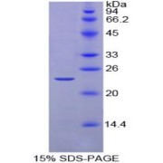 SDS-PAGE analysis of Chicken Noggin Protein.