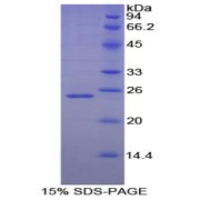 SDS-PAGE analysis of Dog Noggin Protein.