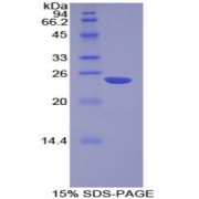 SDS-PAGE analysis of Human NME6 Protein.