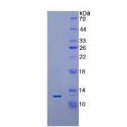 SDS-PAGE analysis of recombinant Human NT-ProBNP Protein.