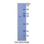 SDS-PAGE analysis of Mouse NFkB2 Protein.