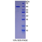 SDS-PAGE analysis of Human NFkB2 Protein.