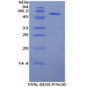 SDS-PAGE analysis of Human NR3C1 Protein.