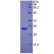 SDS-PAGE analysis of recombinant Human Nucleolin Protein.