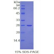 SDS-PAGE analysis of recombinant Human Nucleolin (NCL) Protein.