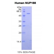 SDS-PAGE analysis of Human Nucleoporin 188 kDa Protein.