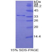 SDS-PAGE analysis of Human Nucleoporin 205 kDa Protein.