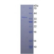 SDS-PAGE analysis of Human Nucleoporin 98 kDa Protein.