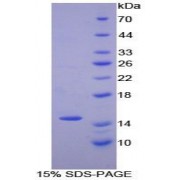SDS-PAGE analysis of Human Numb Homolog Protein.