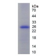 SDS-PAGE analysis of recombinant Human Ornithine Carbamoyltransferase, Mitochondrial (OTC) Protein.