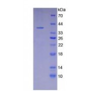 SDS-PAGE analysis of recombinant Human Osteocalcin Protein.