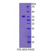 SDS-PAGE analysis of Rat Osteonectin Protein.