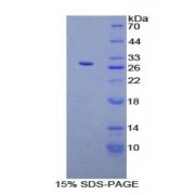 SDS-PAGE analysis of recombinant Human PTHrP Protein.