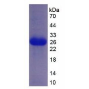 SDS-PAGE analysis of Human Patched 1 Protein.