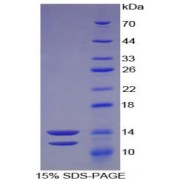 SDS-PAGE analysis of Human Peptide YY Protein.