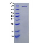 SDS-PAGE analysis of recombinant Mouse Perforin 1 Protein.