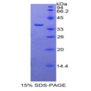 SDS-PAGE analysis of Human Periplakin Protein.