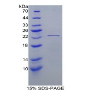 SDS-PAGE analysis of Human Peroxiredoxin 1 Protein.