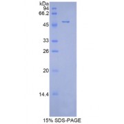 SDS-PAGE analysis of recombinant Mouse Peroxiredoxin 1 Protein.
