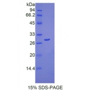 SDS-PAGE analysis of Human Peroxiredoxin 3 Protein.