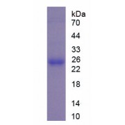 SDS-PAGE analysis of recombinant Mouse Peroxiredoxin 4 Protein.