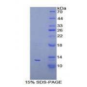 SDS-PAGE analysis of Human PEX2 Protein.