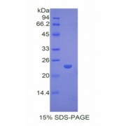 SDS-PAGE analysis of Rabbit PPARG Protein.