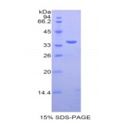 SDS-PAGE analysis of Human SULT1A1 Protein.