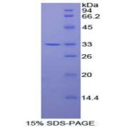SDS-PAGE analysis of Human PDPK1 Protein.