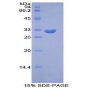 SDS-PAGE analysis of Mouse PIKFYVE Protein.