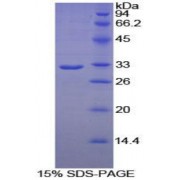 SDS-PAGE analysis of recombinant Human PLA2R1 Protein.