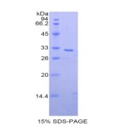 SDS-PAGE analysis of Human MP1 Protein.