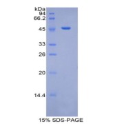 SDS-PAGE analysis of recombinant Human Plasminogen Protein.